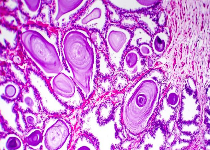 Histopathology