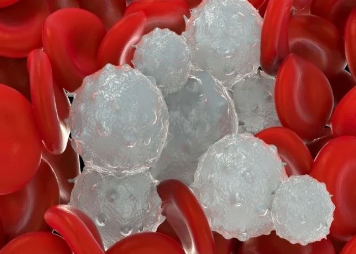 Pediatric white blood cell disorders