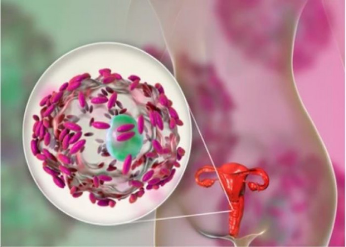 Bacterial vaginosis