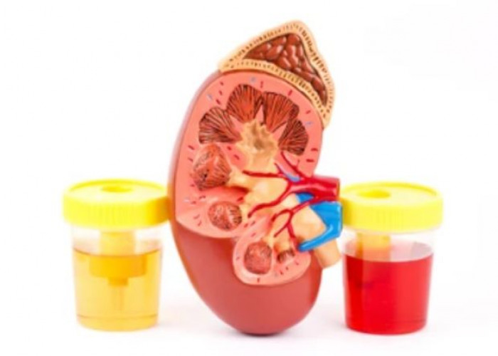 Blood in urine (hematuria)