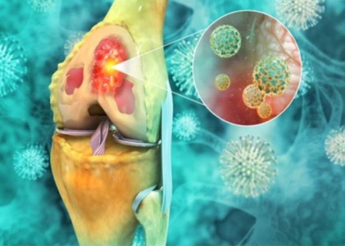 Bone cancer