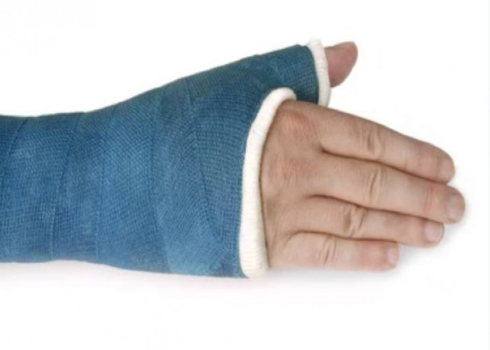 Broken wrist