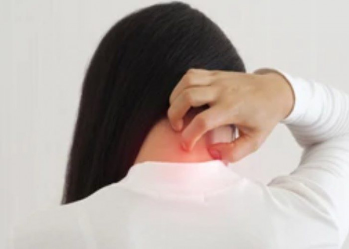 Cervical dystonia