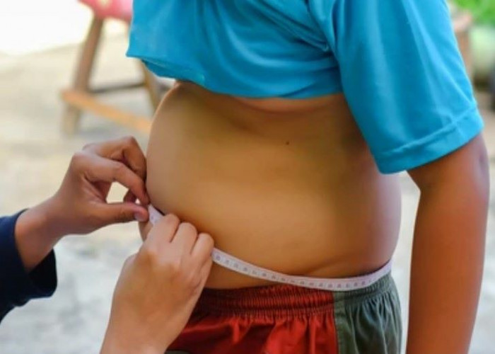 Childhood obesity