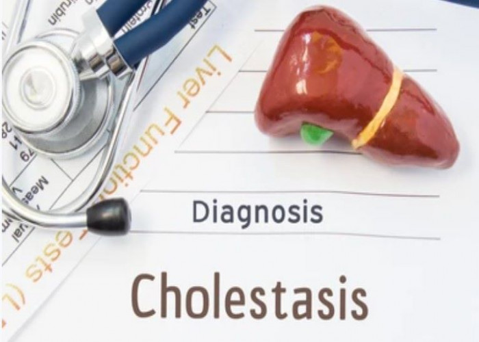 Cholestasis of pregnancy