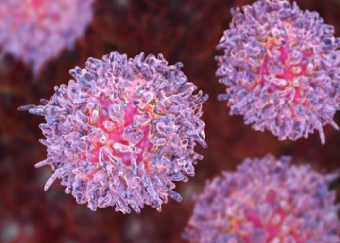 Chronic lymphocytic leukemia