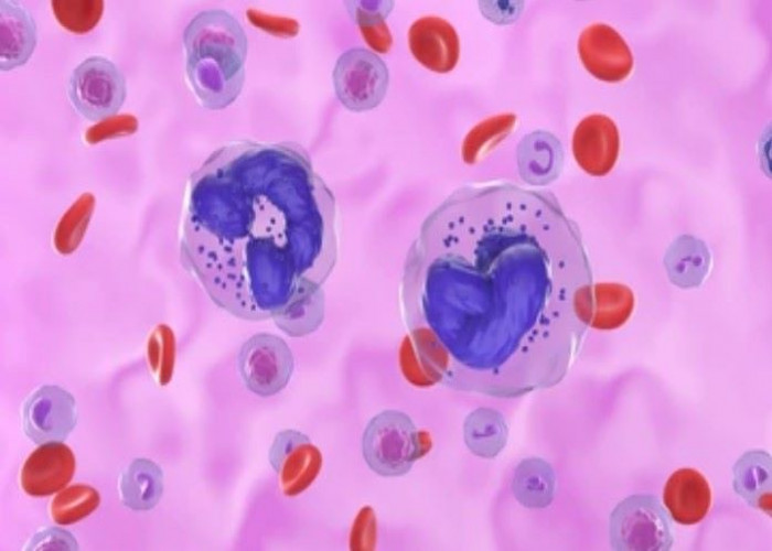 Chronic myelogenous leukemia