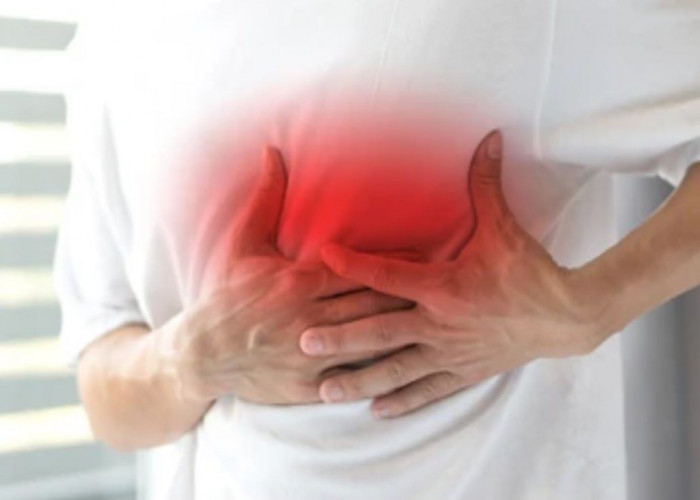 Costochondritis