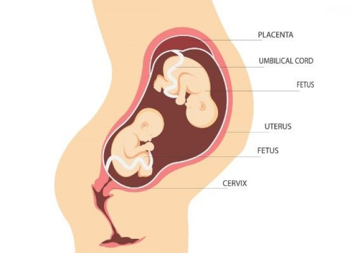 Double uterus