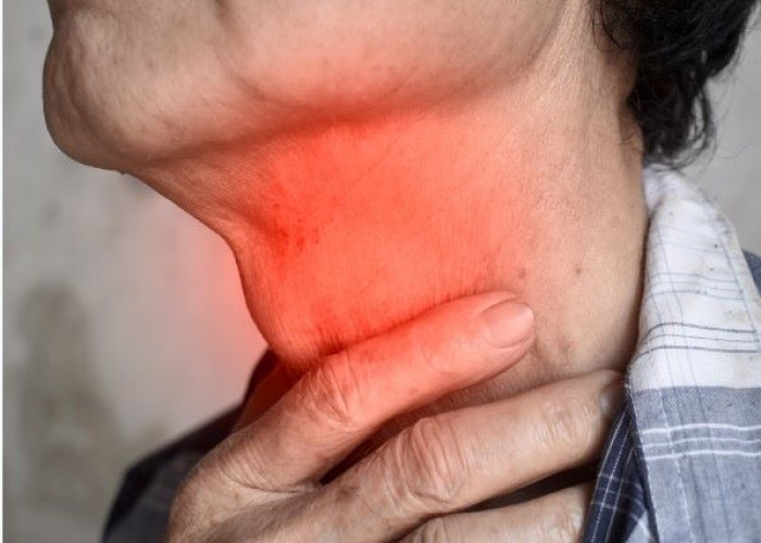 Dysphagia