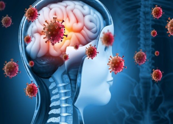 Encephalitis