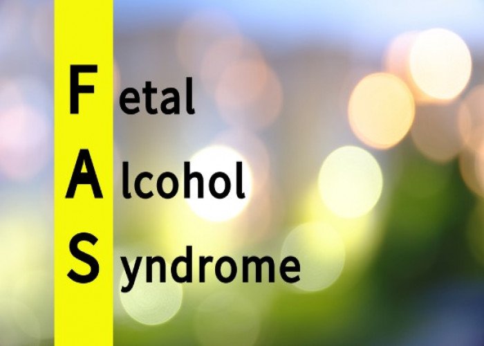 Fetal alcohol syndrome