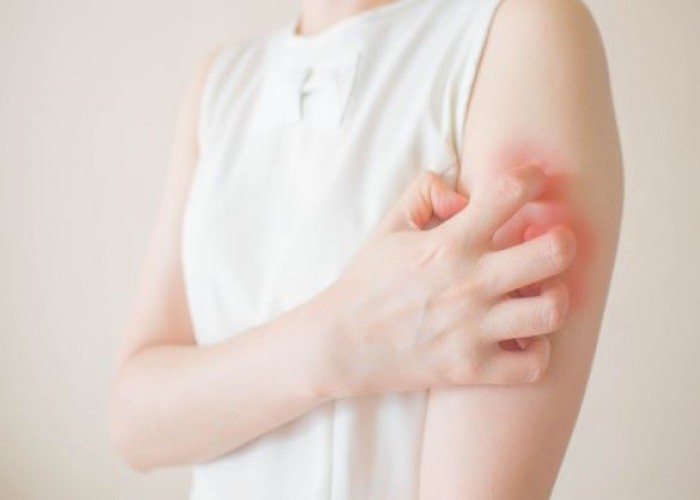 Food allergy