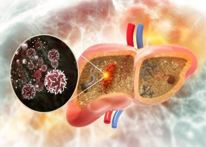 Gallbladder cancer