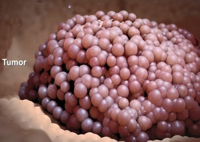 Germ cell tumors
