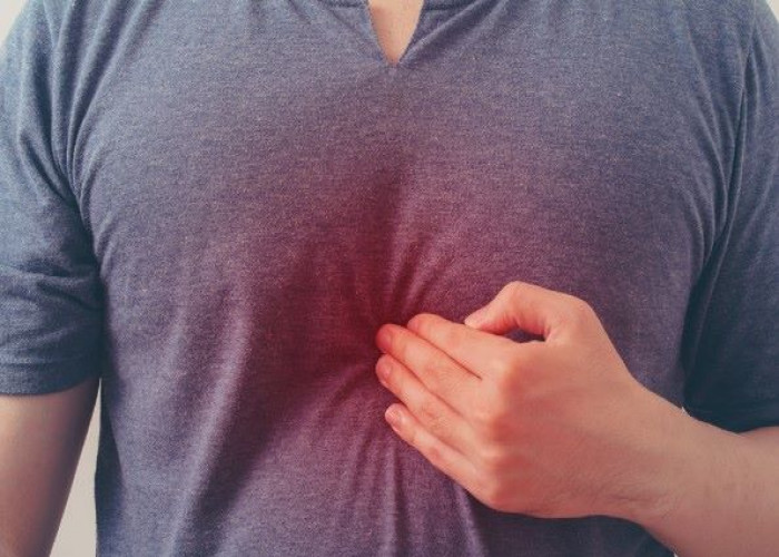 Heartburn
