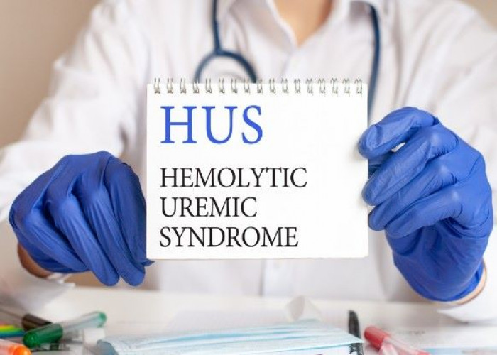 Hemolytic uremic syndrome (HUS)