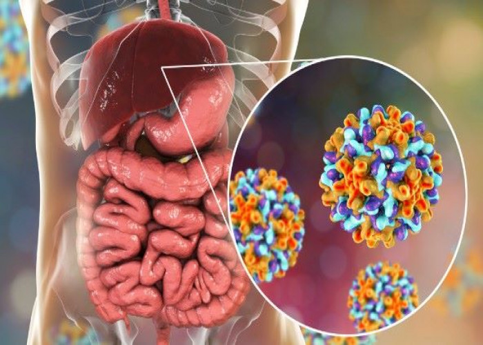 Hepatitis B