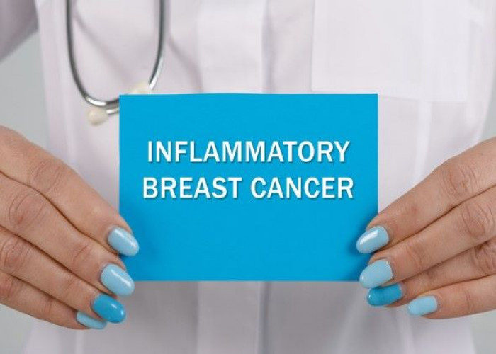 Inflammatory breast cancer
