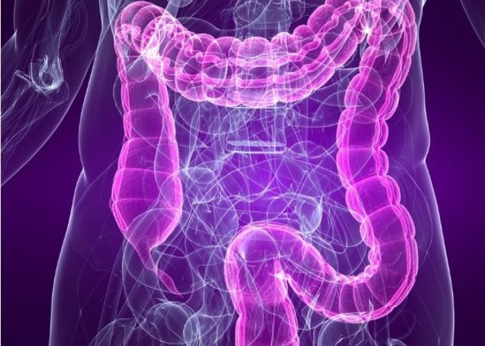 Irritable bowel syndrome
