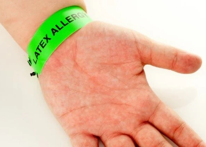 Latex allergy
