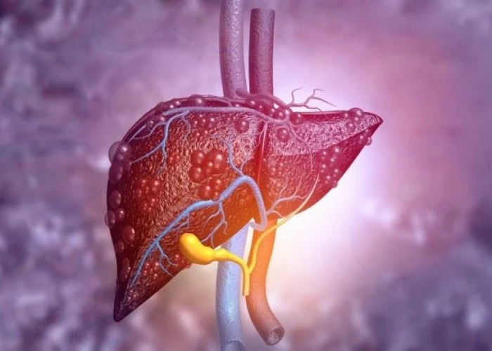 Liver disease