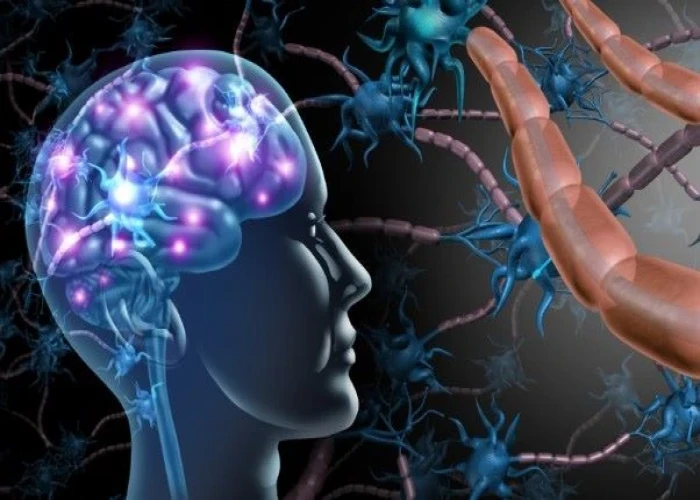 Multiple sclerosis