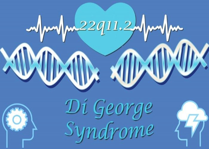 Digeorge syndrome (22q11.2 deletion syndrome)