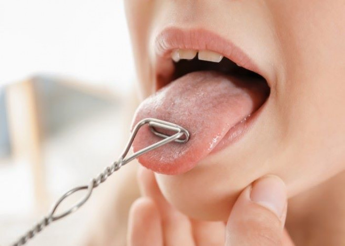 Dysarthria