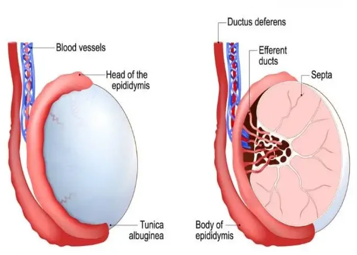 Spermatocele
