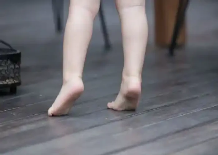 Toe walking in children