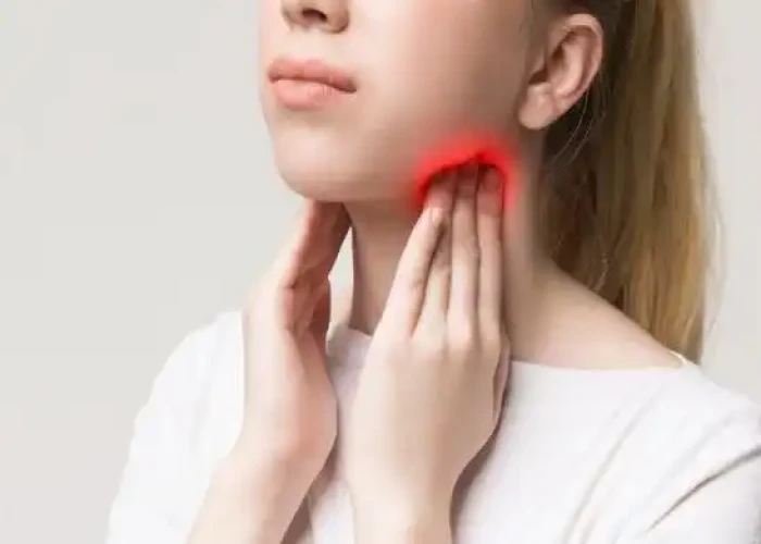 Tonsil cancer