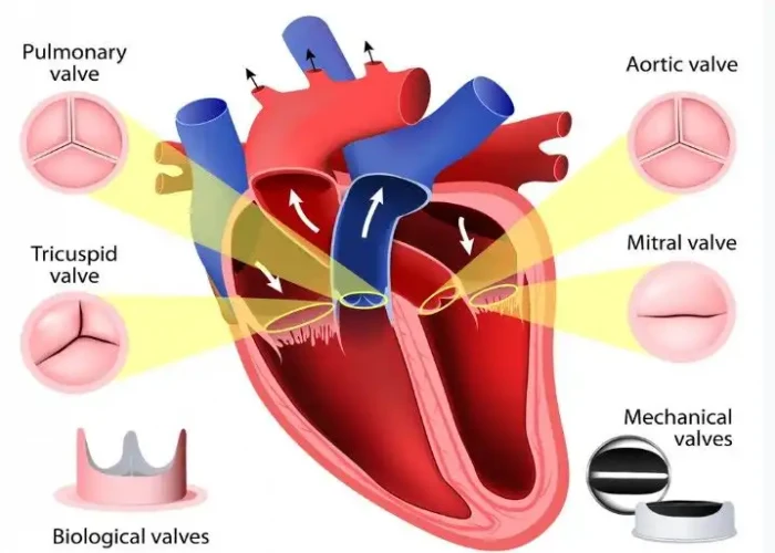 Tricuspid valve disease