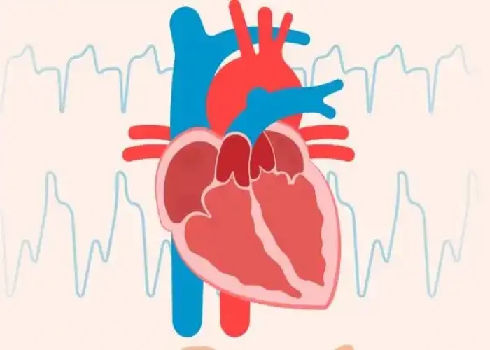 Truncus arteriosus