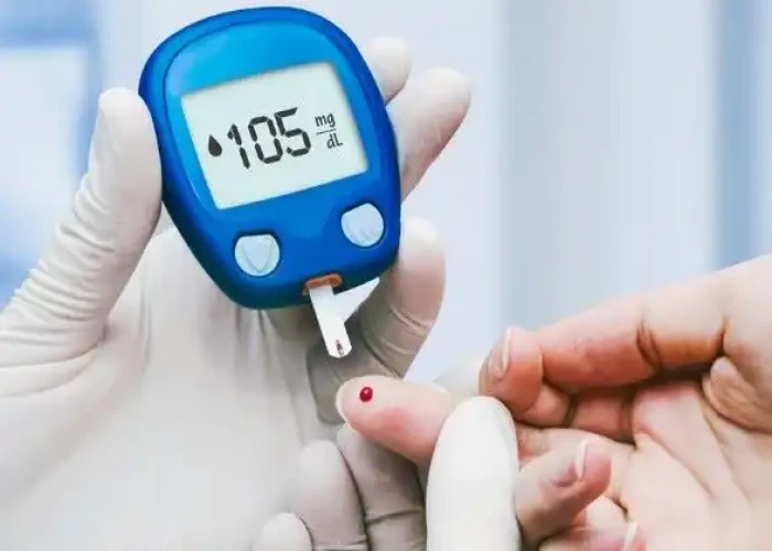 Type 2 diabetes