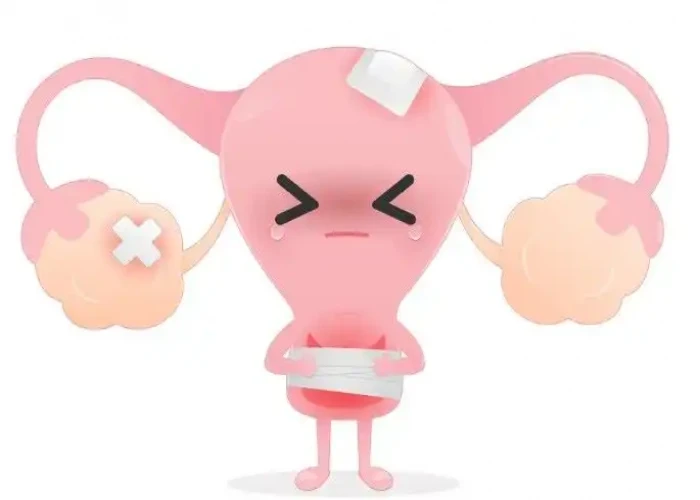 Uterine Inflamation (Cervicitis)