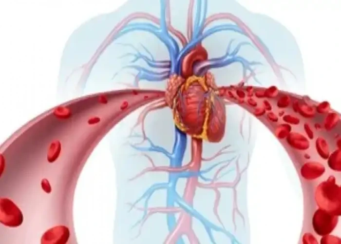 Vitamin deficiency anemia