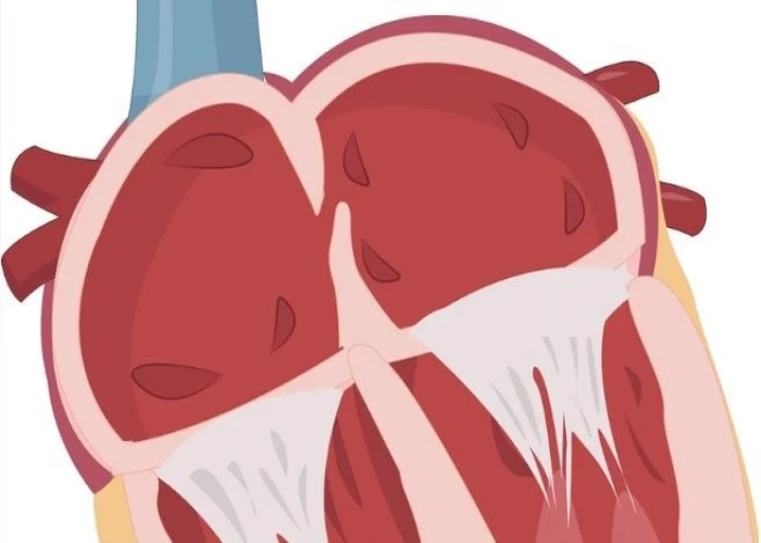 patent foramen ovale