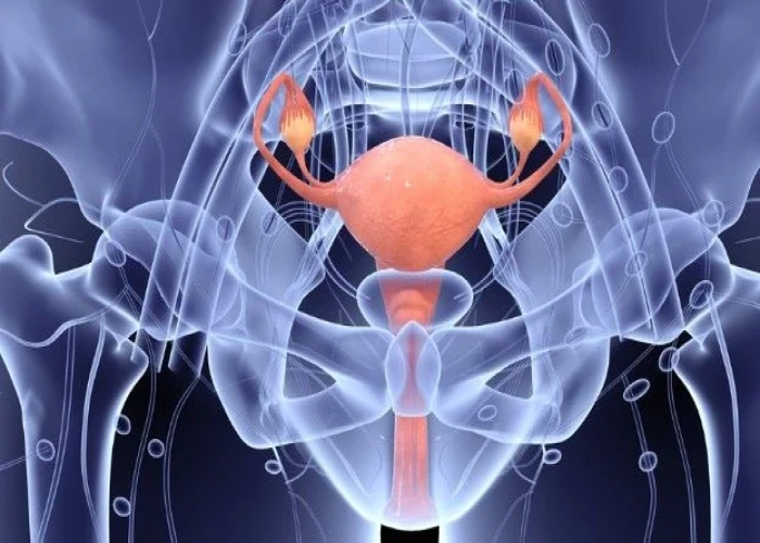 Posterior vaginal prolapse (rectocele)
