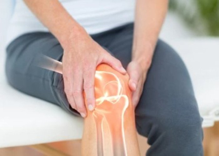 Knee arthritis