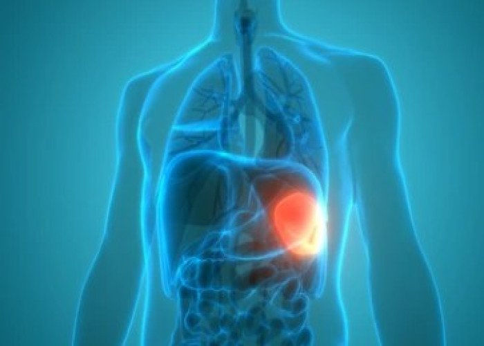 Spleen and liver swelling