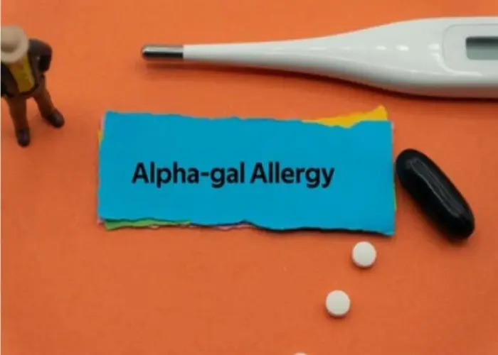 Alpha-gal syndrome