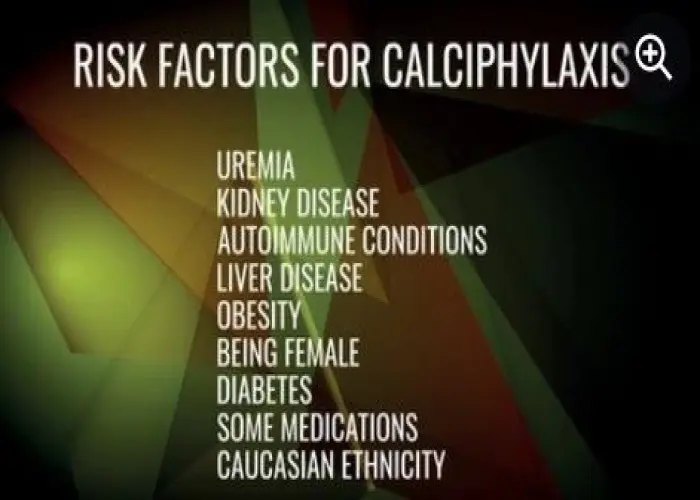 Calciphylaxis