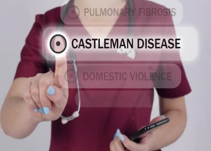 Castleman disease