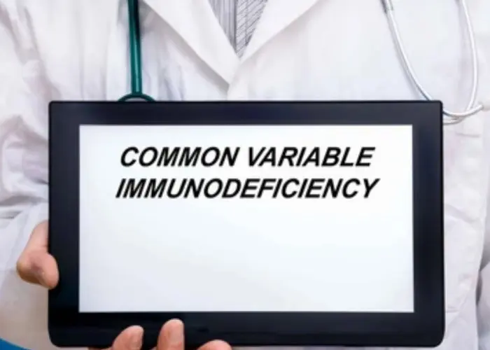 Common variable immunodeficiency