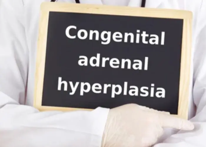 Congenital adrenal hyperplasia