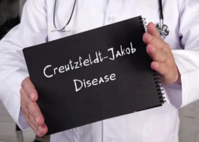 Creutzfeldt-Jakob disease