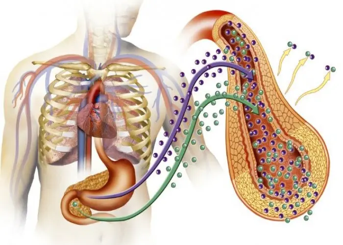 Diabetic hyperosmolar syndrome