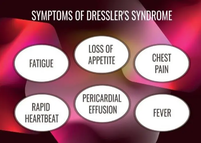 Dressler syndrome