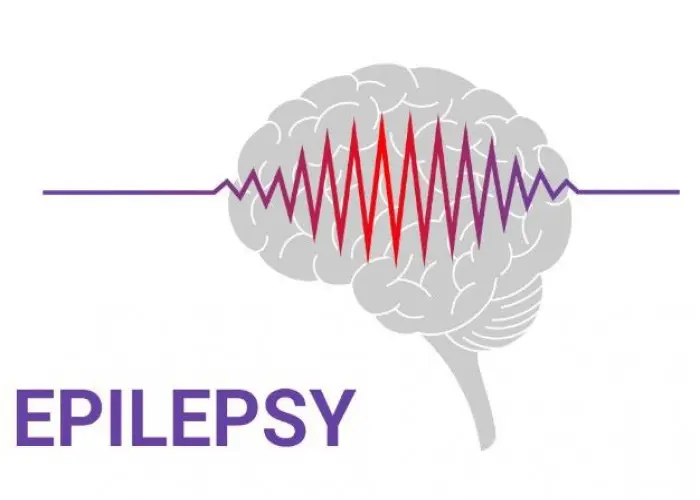 Epilepsy